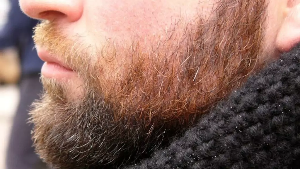 caspas na barba