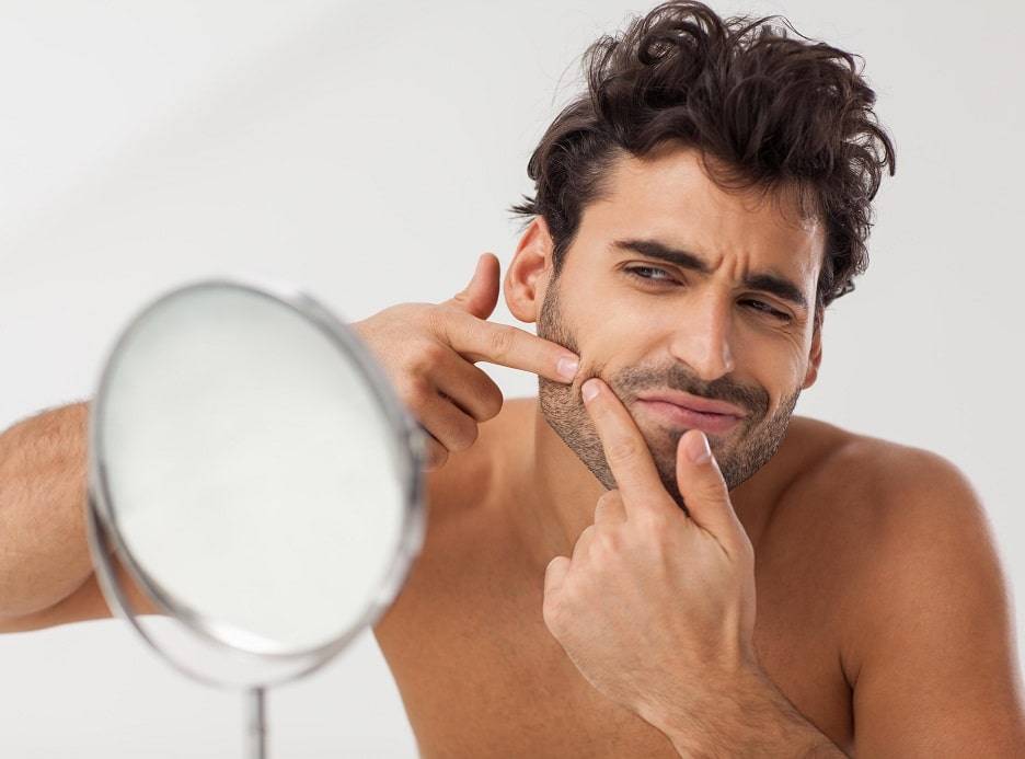 Pelo encravado na barba como evitar Don Alcides