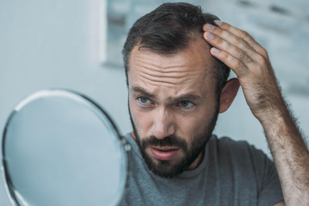 3 cortes de cabelo para disfarçar a calvície – You Man Grooming